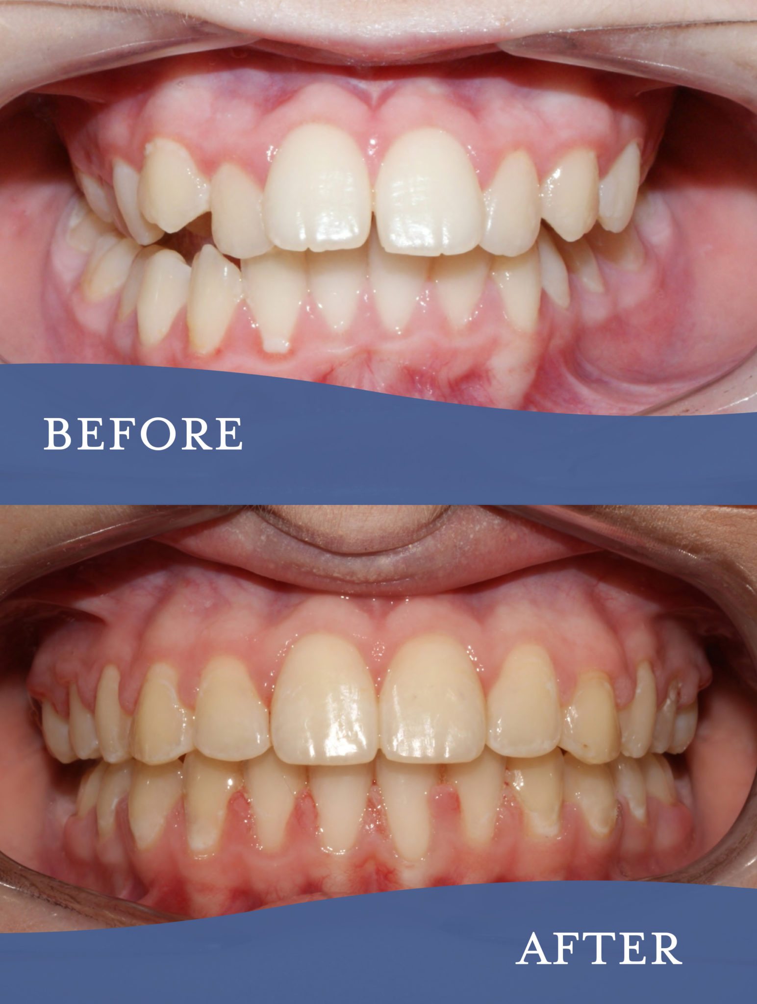 Gallery Barlow Orthodontics