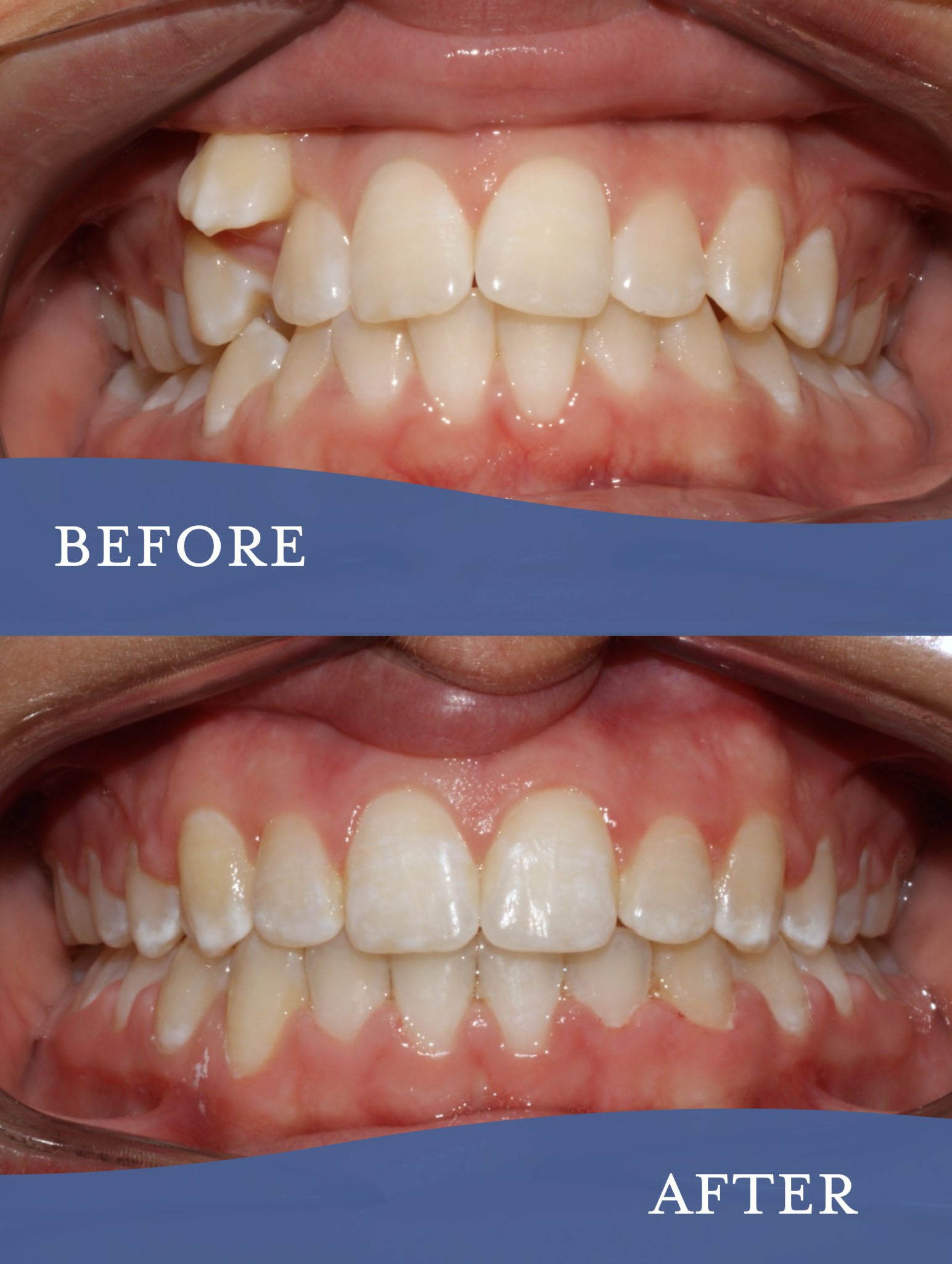 Gallery Barlow Orthodontics