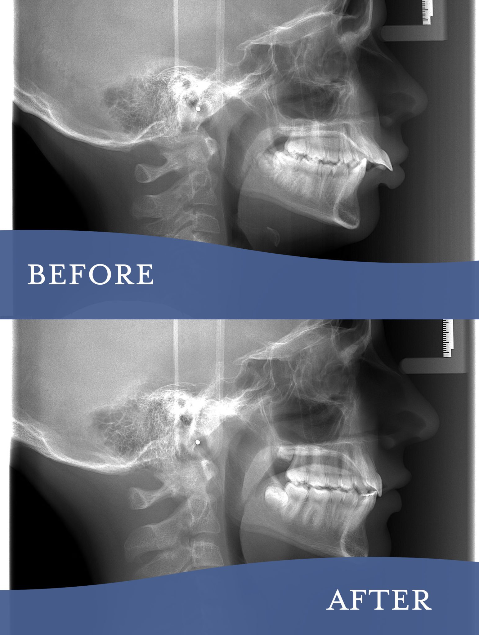 Gallery Barlow Orthodontics