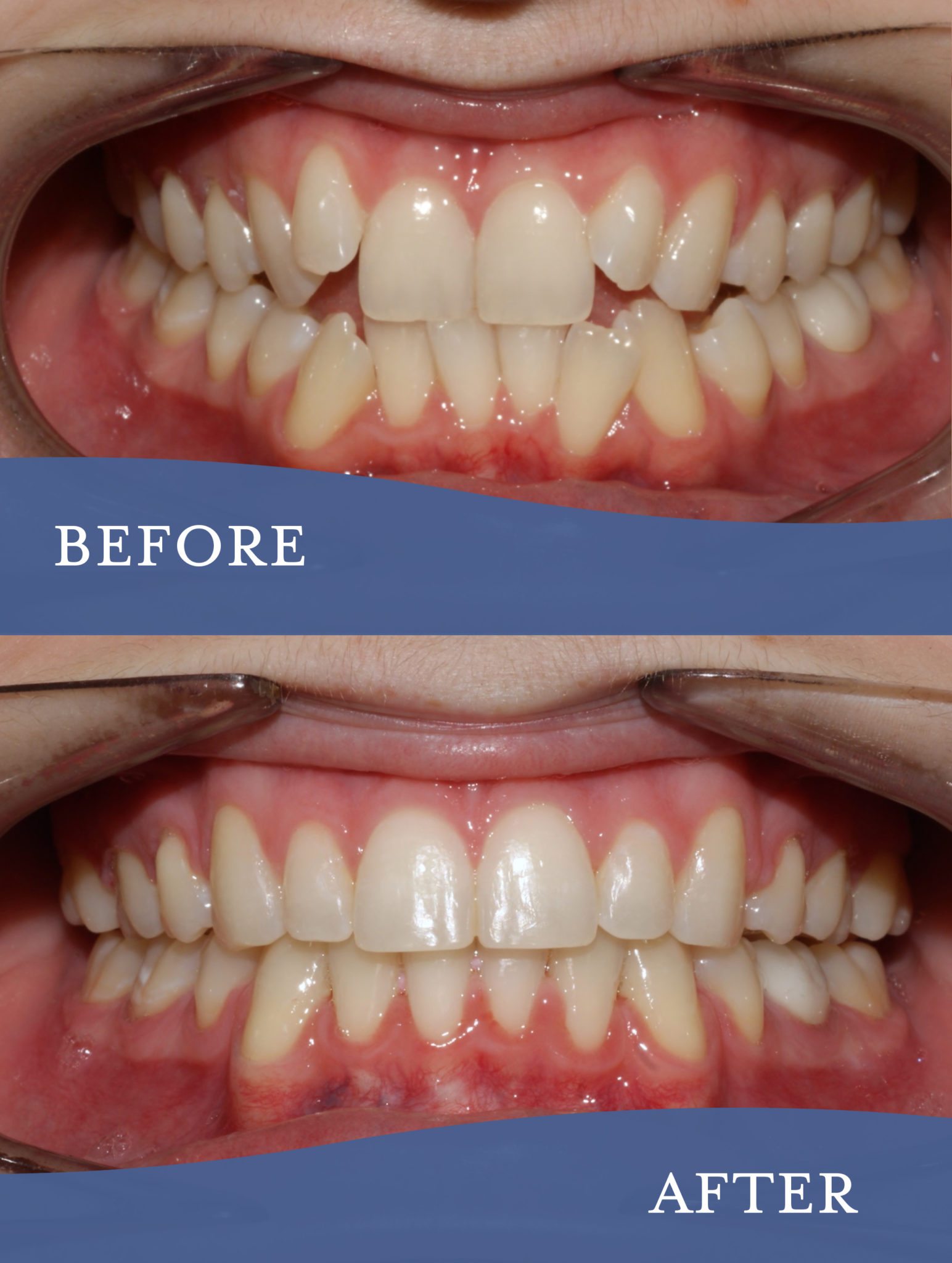 Gallery Barlow Orthodontics