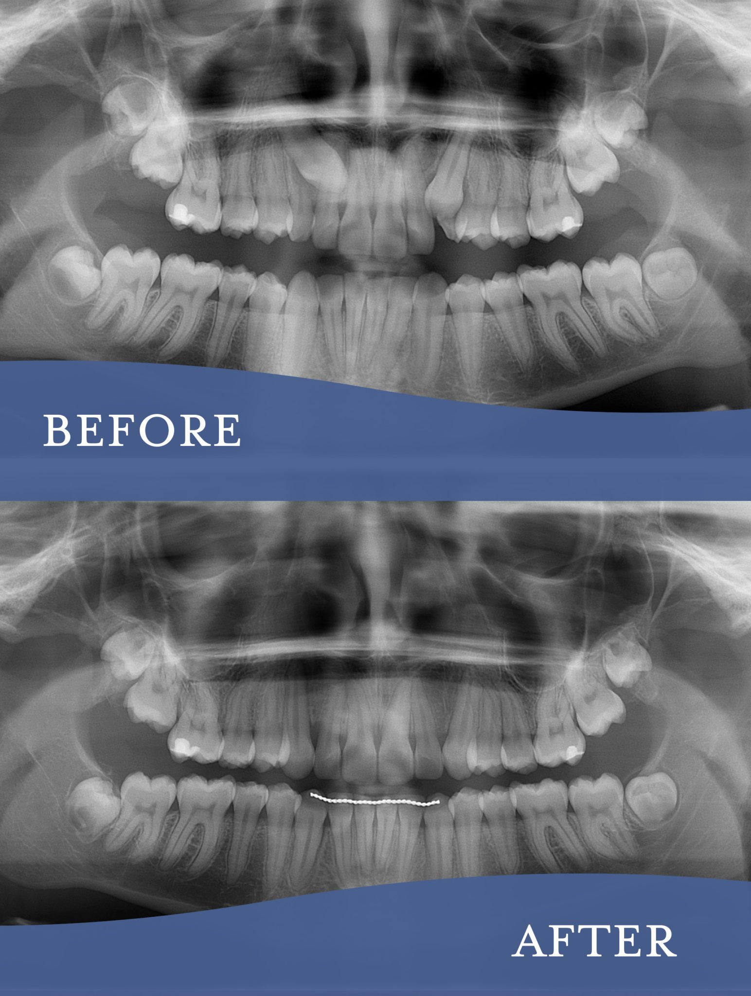 Gallery Barlow Orthodontics