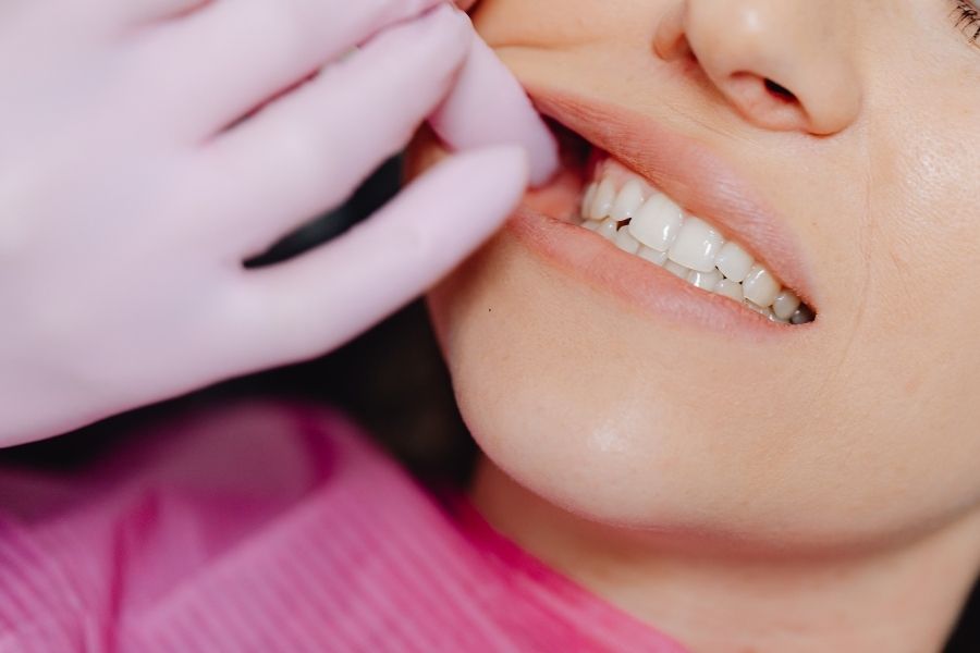 how to correct underbite​
