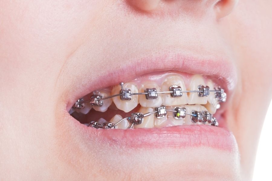 How to Handle a Pokey Wire or Loose Bracket at Home