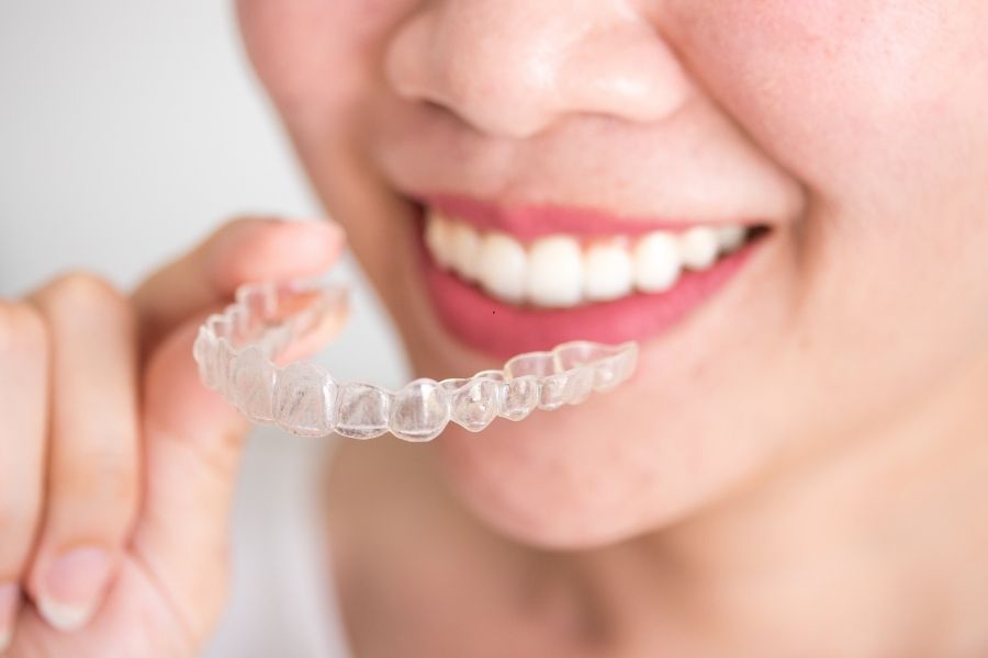how long does invisalign take for crowded teeth