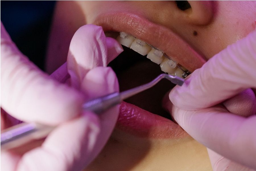 Emergency Orthodontic Care & Broken Appliance Repairs