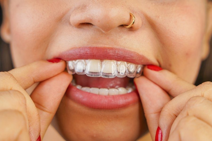 can i eat with invisalign