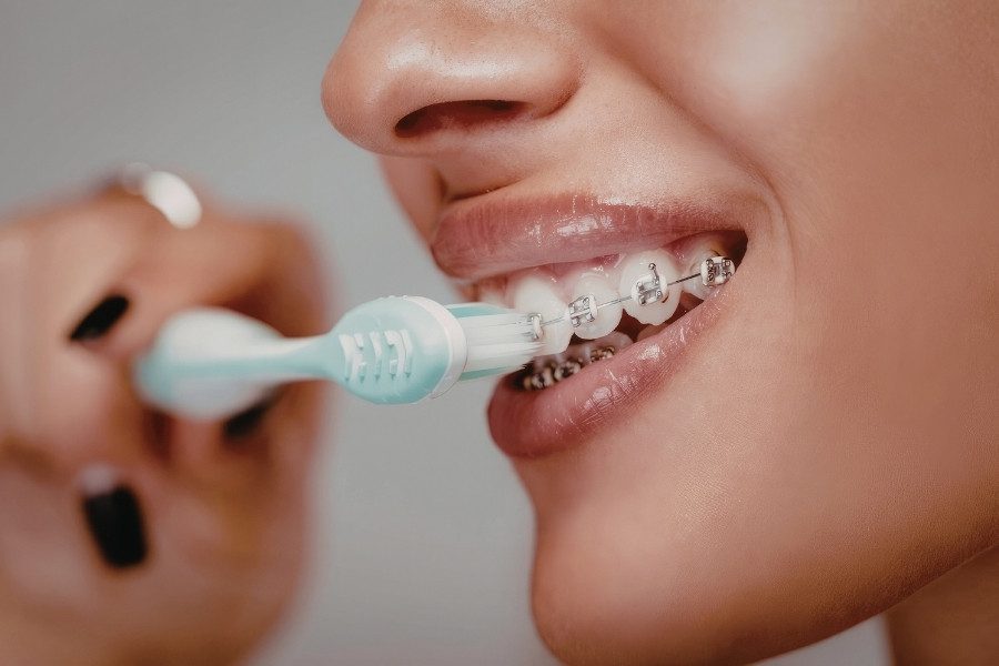 gum disease with braces