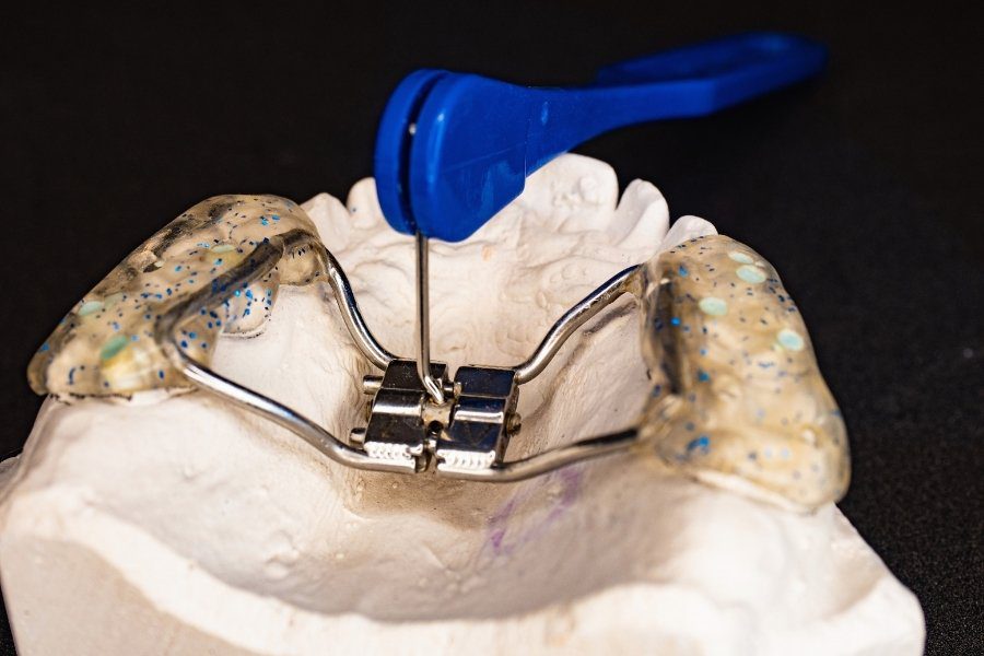 how much does a palate expander cost